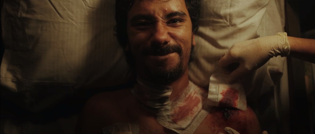 Las pústulas, otro síntoma de la enfermedad en Contagio en alta mar